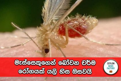 ලීෂ්මේනියාසිස්