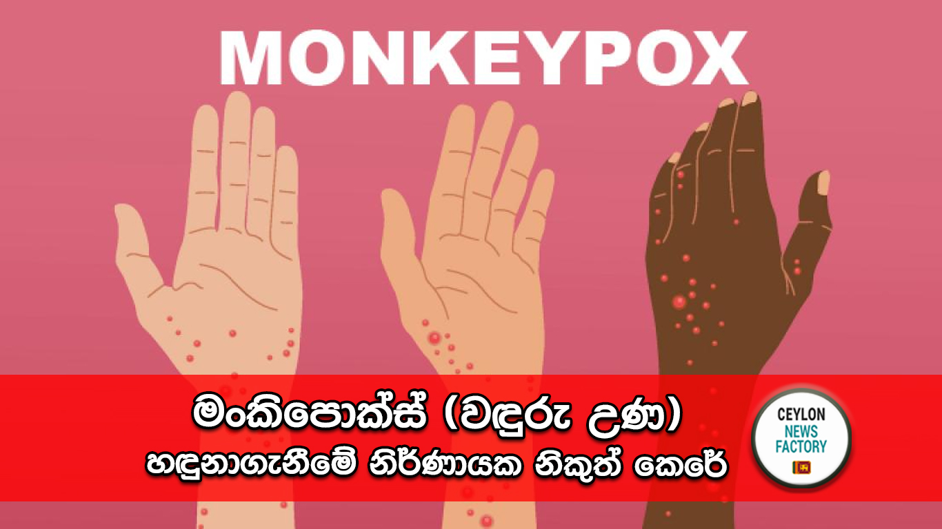 මංකිපොක්ස් (වඳුරු උණ)