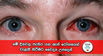 මේ දිනවල පැතිර යන ඇස් රෝගයෙන් වැළකී සිටීමට වෛද්‍ය උපදෙස් !